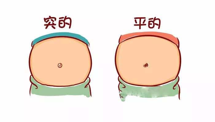 肚脐的形状决定了你的健康,如何根据肚脐形状了解身体
