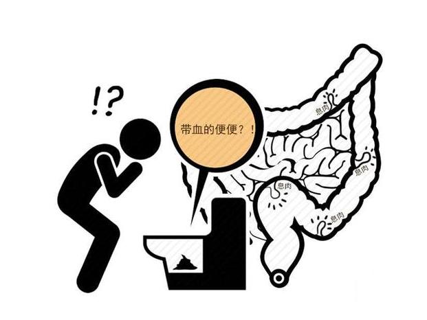 身体抱恙的解释,身体有癌症大便会预警