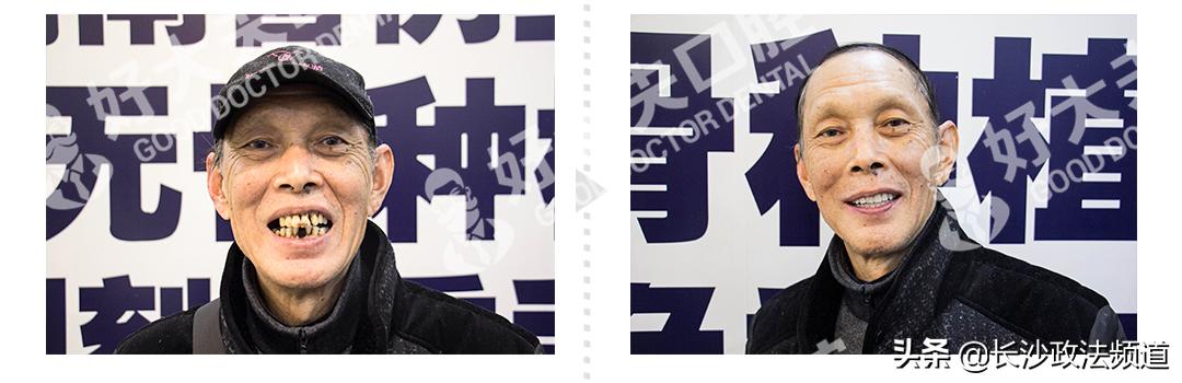 湖南人有消费券吗,湖南省2021看牙补贴政策是真的吗