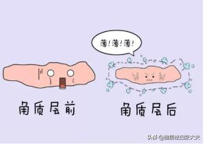 女性白癜风抹药后痒是怎么回事,白癜风处起红疹是怎么回事