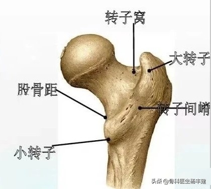 老人摔骨折多长时间能正常走路,老人摔倒哪种骨折最可怕