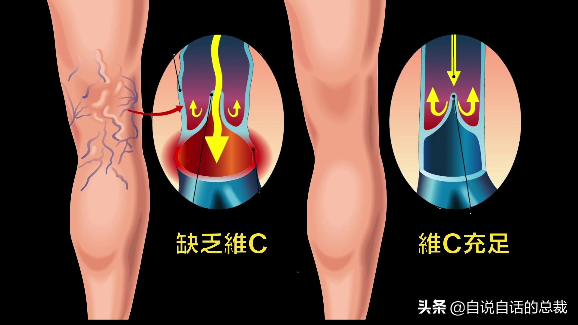 全世界的柠檬都读Lemon?这背后有一个刻在8号染色体上的上古故事
