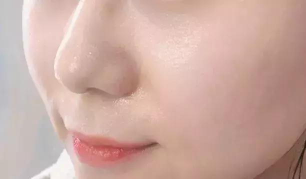 吸黑头神器去粉刺角质收缩毛孔,皮肤清洁收缩毛孔黑头角质