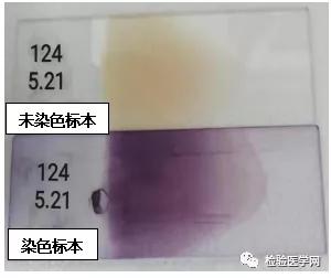 “秒”看血小板聚集，你get到了吗？