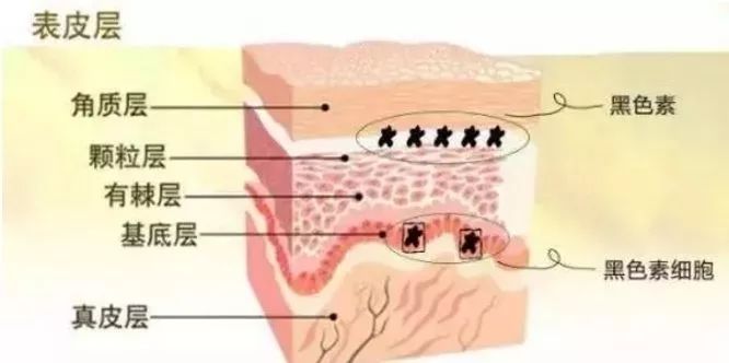 激光祛斑反黑多久能恢复正常肤质,祛斑后反黑能用美白产品吗