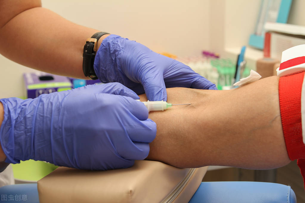 乳腺癌化疗后脱发,乳腺癌化疗后脱发正确方法