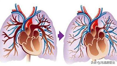 免疫类不良妊娠北京哪个医院能治,免疫不良妊娠怎么处理