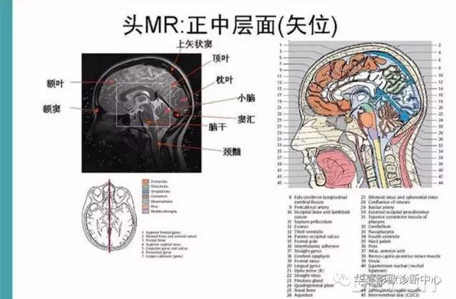 mra头颅解剖学详细讲解视频,常见的头颅mri图像