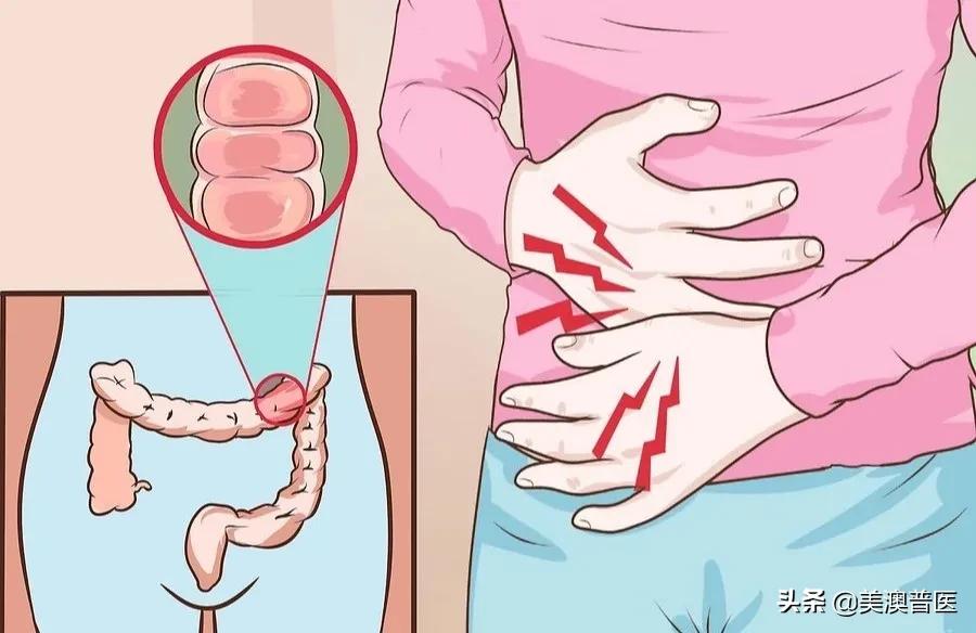肚子左右两侧疼是肠胃问题吗,肠胃哪些问题会引发肚子疼