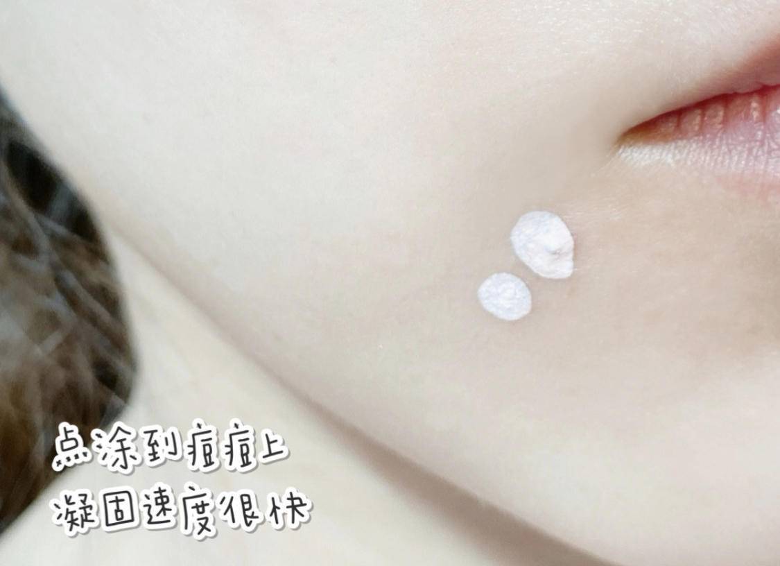 濂崇敓鐖嗙棙蹇呬拱娓呭崟鑽啅,鐖嗙棙浜у搧蹇呬拱娓呭崟