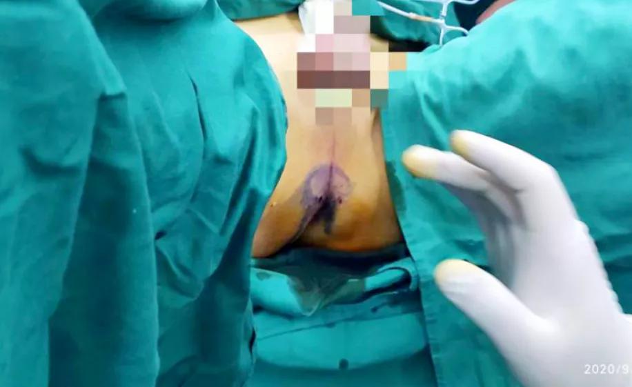 逐梦而来，穿刺而行|潍坊市刺客联盟成立大会暨第一届前列腺穿刺培训班成功举办