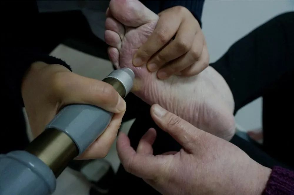 龙之杰体外冲击波疼痛治疗仪,体外冲击波疼痛治疗仪