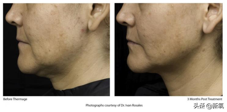 很多人夸赵丽颖,赵丽颖都被谁夸过