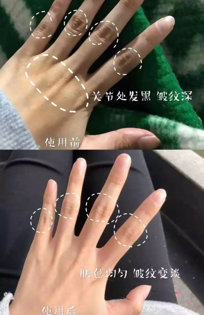 怎么变白又快又有效不花一分钱,最有效的变白方法学生党