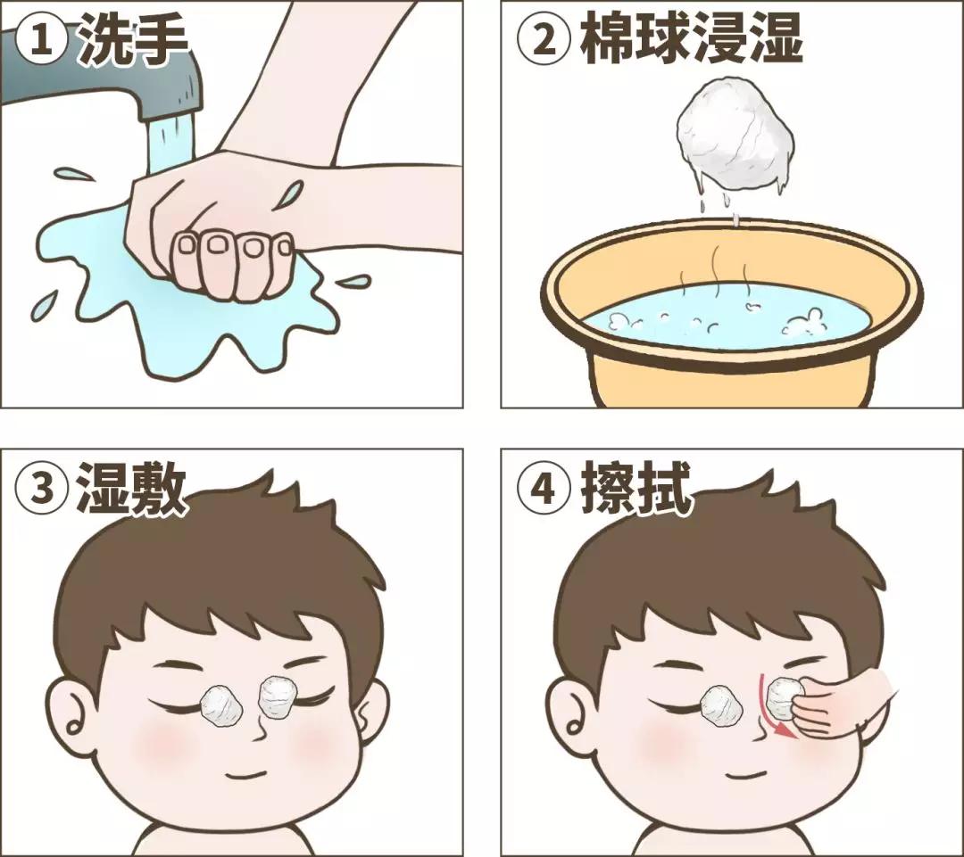 眼屎黄粘稠是哪里上火,体内上火嗓子痛眼屎严重怎么办