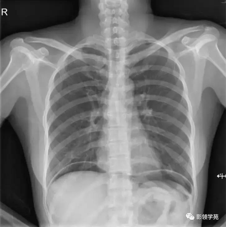 16种常见急性腹痛的诊断与鉴别