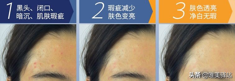 sk2小灯泡美白原理,sk小灯泡精华能美白吗