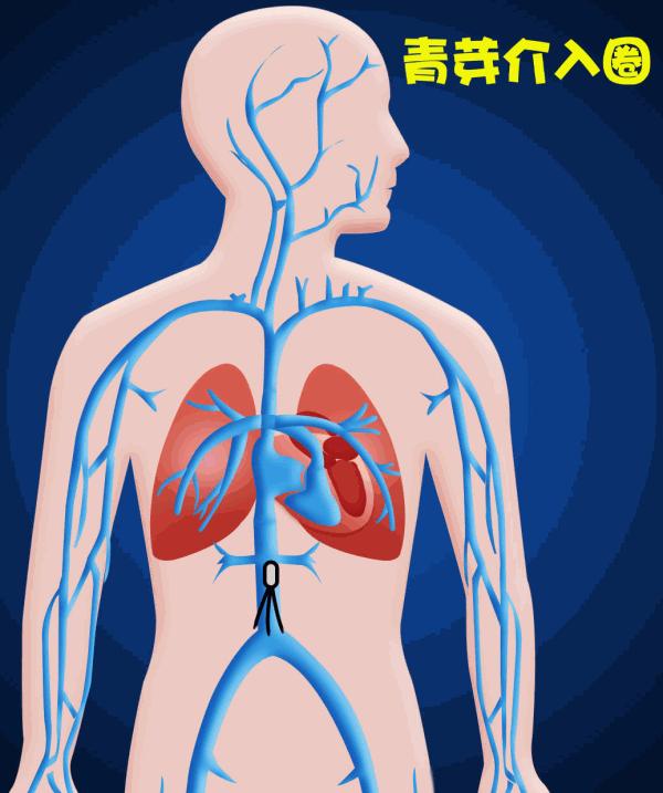 腿肿要警惕四种病,人的腿肿是什么病的前兆