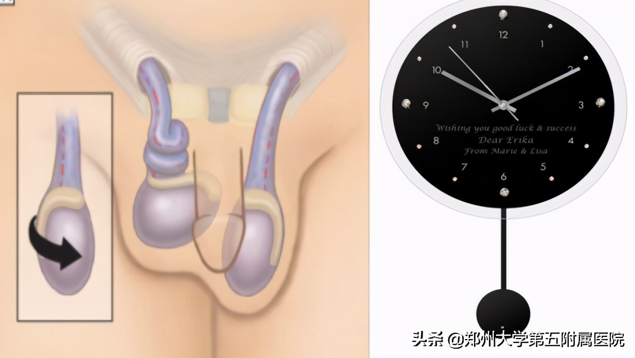 蛋蛋的忧伤原版,蛋蛋的忧伤拳击