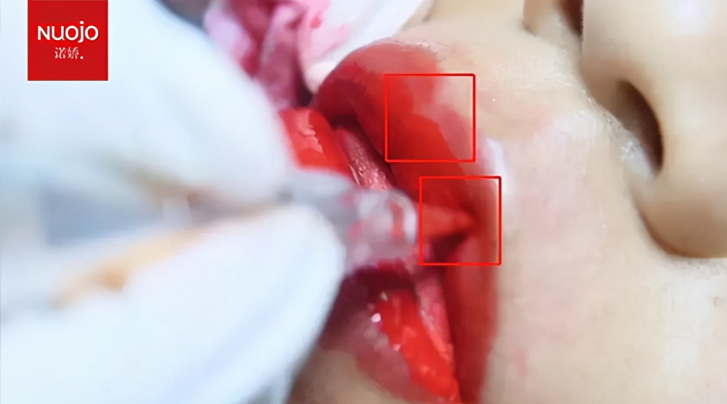 纹绣唇太红了怎么转淡,纹唇时纹绣师需准备哪些