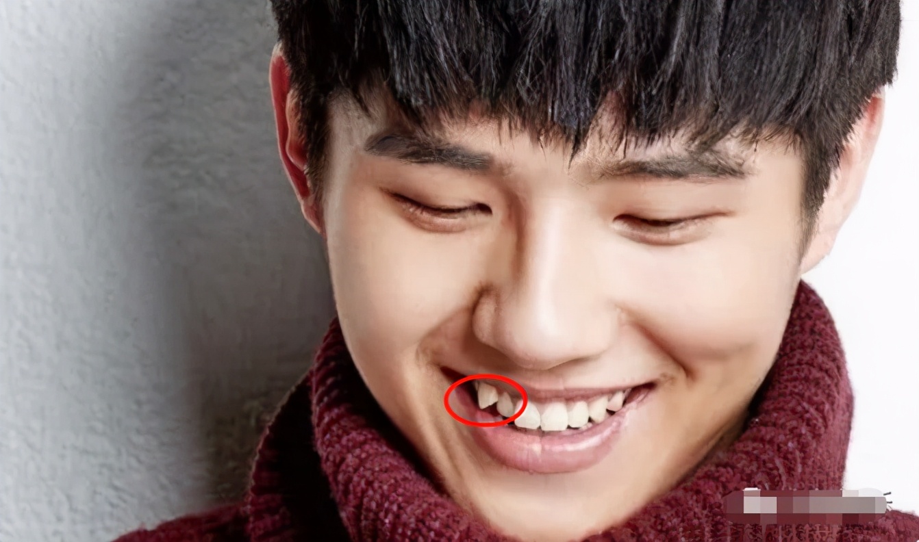 明星做了烤瓷牙翻车,烤瓷牙李佳琦