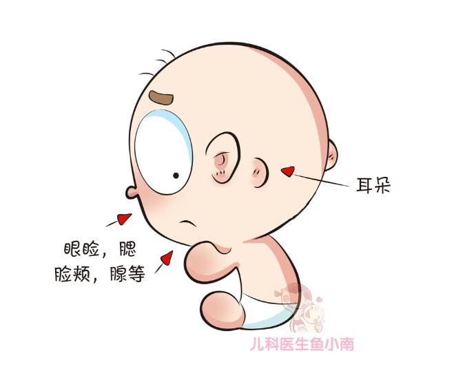宝宝耳后脖子处按压有疙瘩,儿童耳后有个硬疙瘩挂哪一科