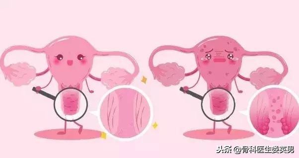 得了宫颈癌别放弃,宫颈癌该如何自救