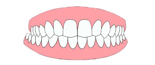 带你了解超详细的牙齿矫正过程,牙齿矫正全过程看完你就知道