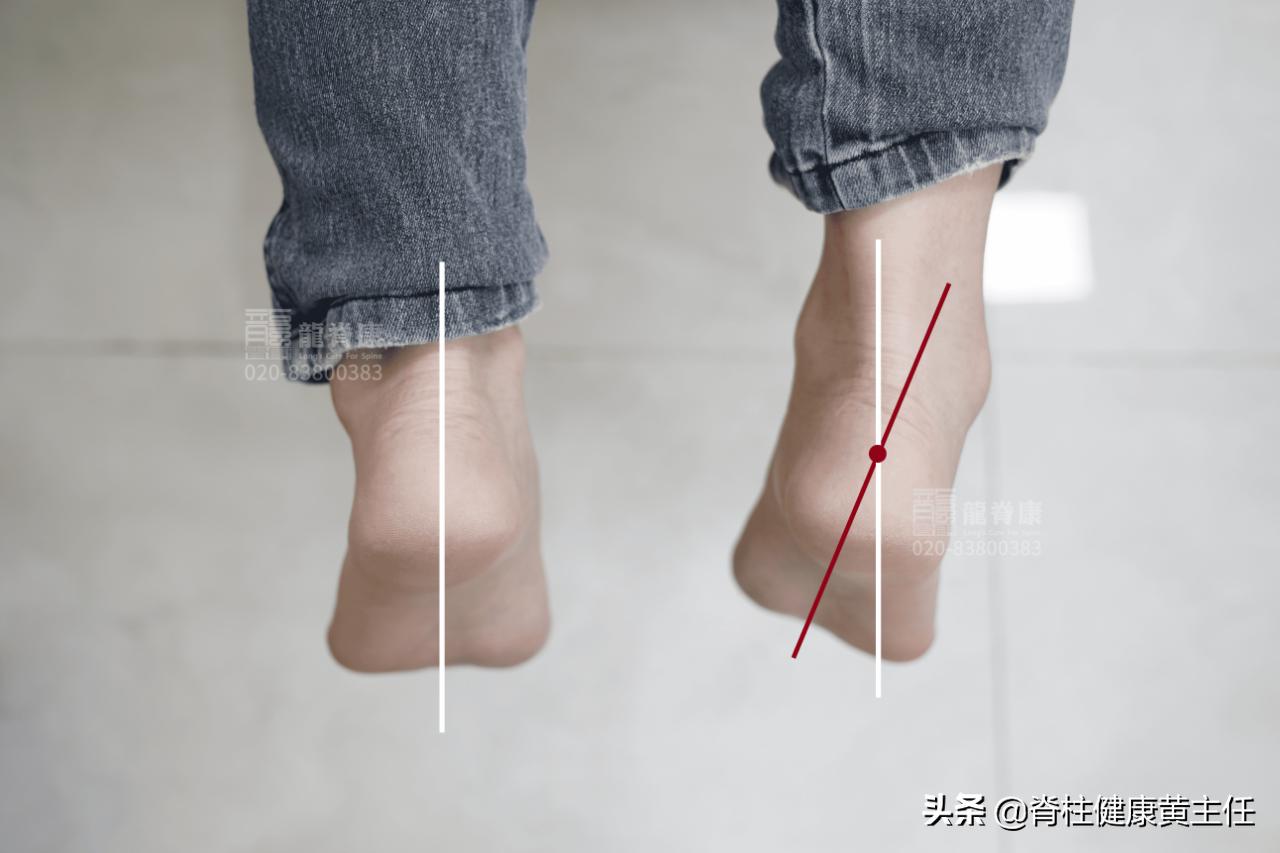 以前脚踝扭伤了现在经常会隐隐痛,脚踝扭伤后一直隐隐作痛怎么办