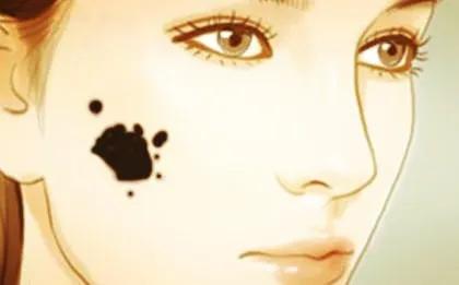 黑毛胎记科普,长满胎记的人