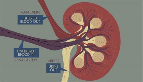 肾囊肿到底是怎么回事啊严不严重,了解肾囊肿最佳治疗方法是什么