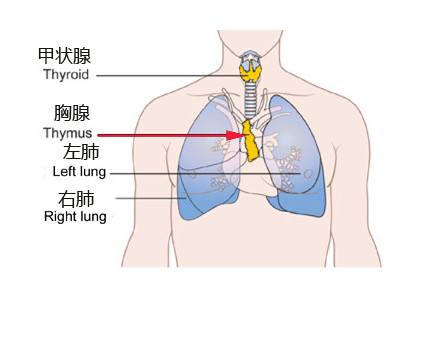 临床招募：广泛期小细胞肺癌患者——胸腺癌