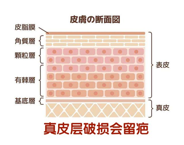 宝宝蚊子咬了快速止痒,宝宝蚊子咬药膏止痒除疤痕