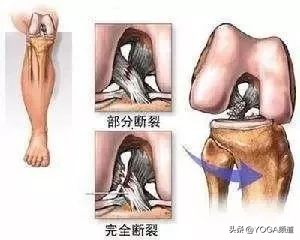 怎么拉伸韧带视频教程,怎样拉伸韧带不容易受伤