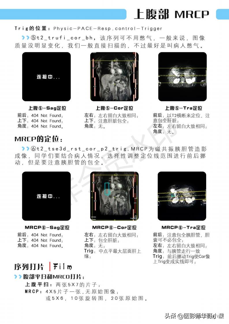 磁共振扫描技术西门子,西门子磁共振最新操作界面