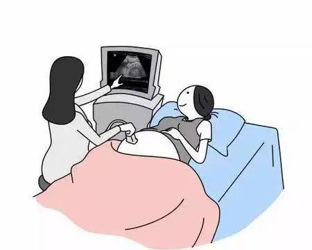 多囊容易怀双胞胎,多囊怀孕有多大几率是双胞胎