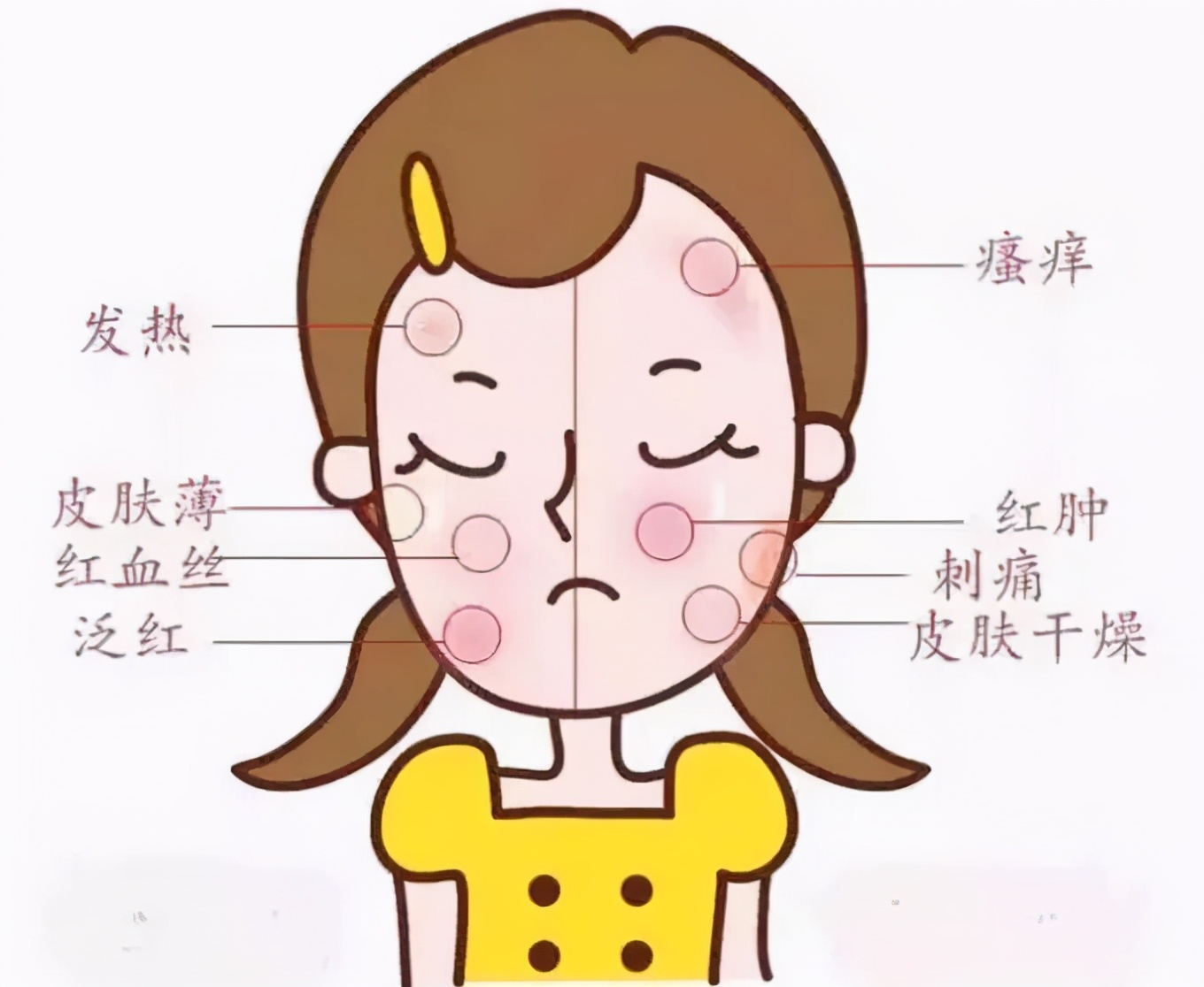 烂脸的水乳千万别买,烂脸水乳