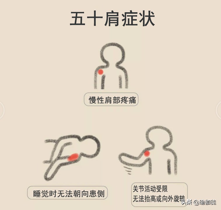 五十肩真的自己就能好了吗,五十肩的好处和坏处