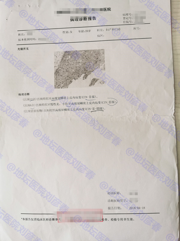 hpv16cin3锥切后会转阴几率,病例分享报告