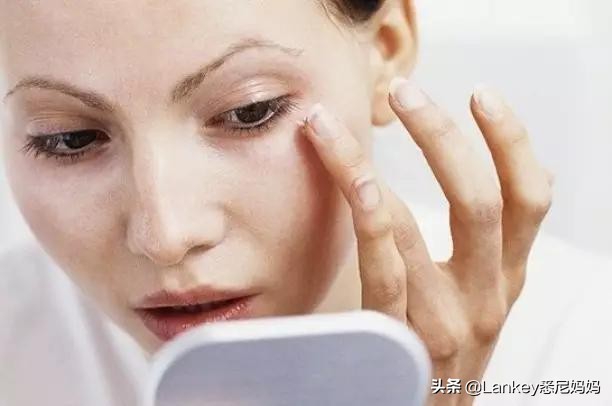 真性皱纹的定义假性皱纹的定义,一笑才有的皱纹是假性皱纹吗