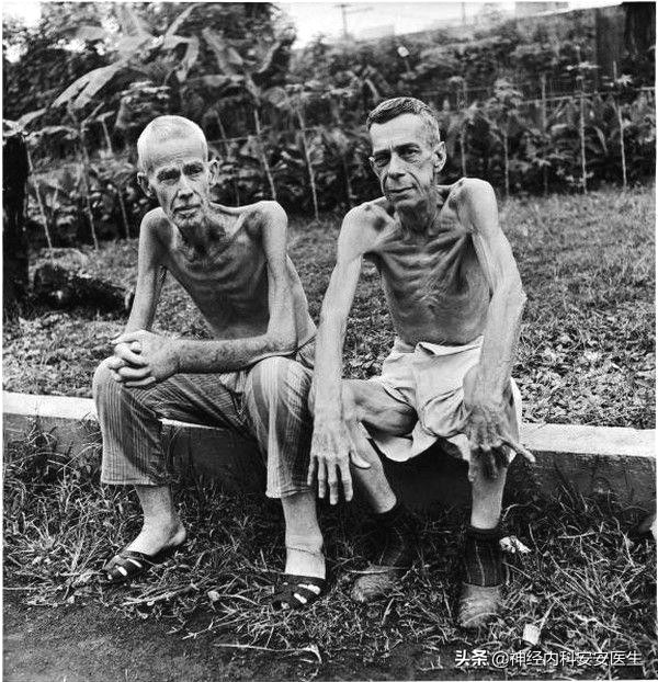 产后手脚浮肿是什么原因,怀孕手脚浮肿是什么原因引起的