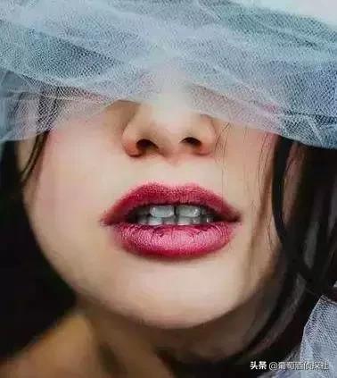 喝酒牙齿变黄怎么办,喝酒牙齿变黑是怎么回事