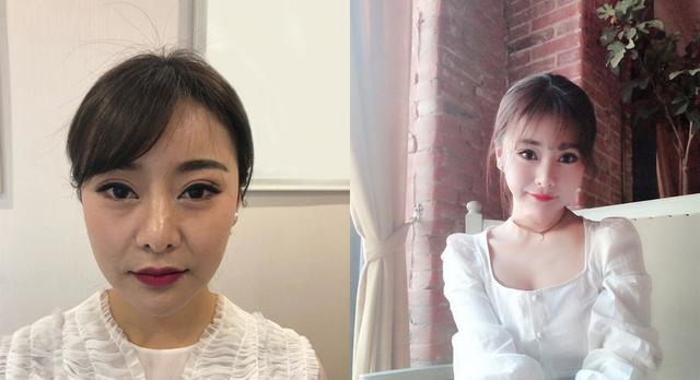 胶原蛋白该怎么补,脸上胶原蛋白流失严重怎么补最好