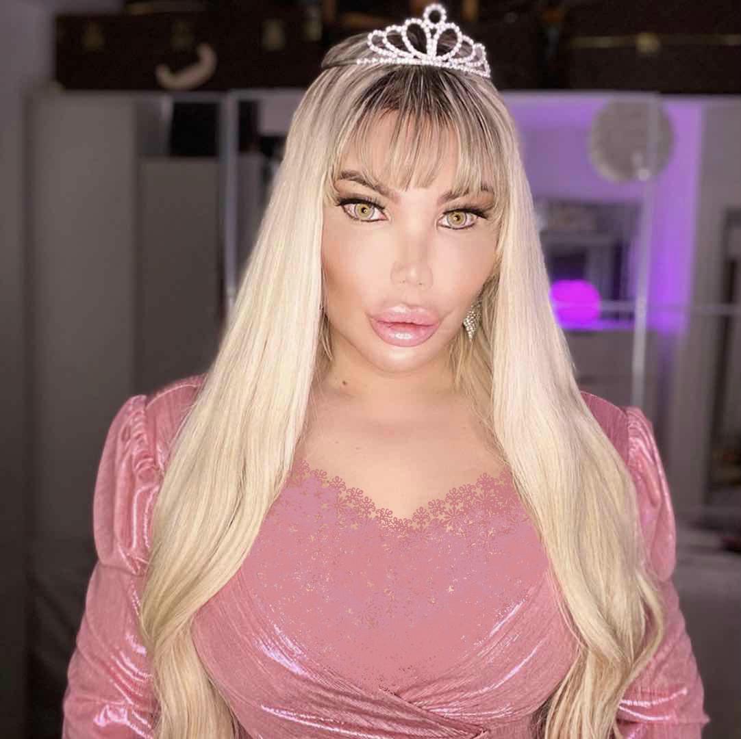 巴西男整容42次图片,巴西男模花数百万整容