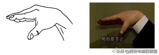 康复理疗师视频教程全集中文,足部康复训练6个动作