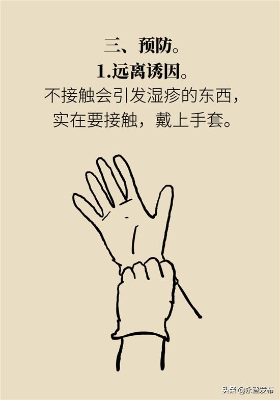 湿疹膏有哪些治疗效果好的,湿疹膏可以治愈吗