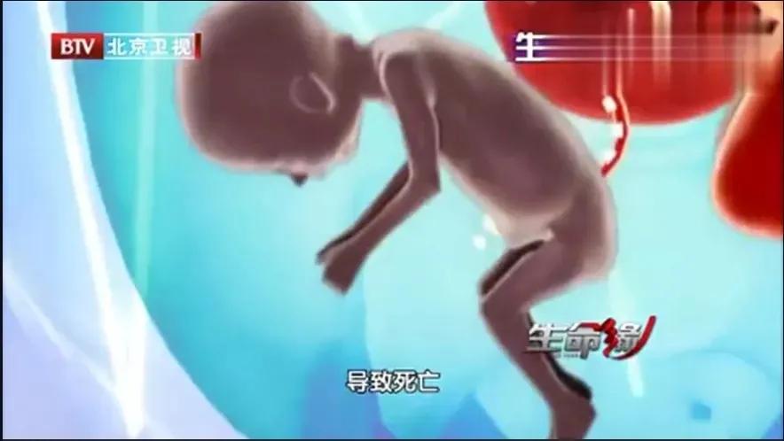 产妇胎心骤降胎儿命悬一线,产妇胎儿宫内窘迫抢救措施