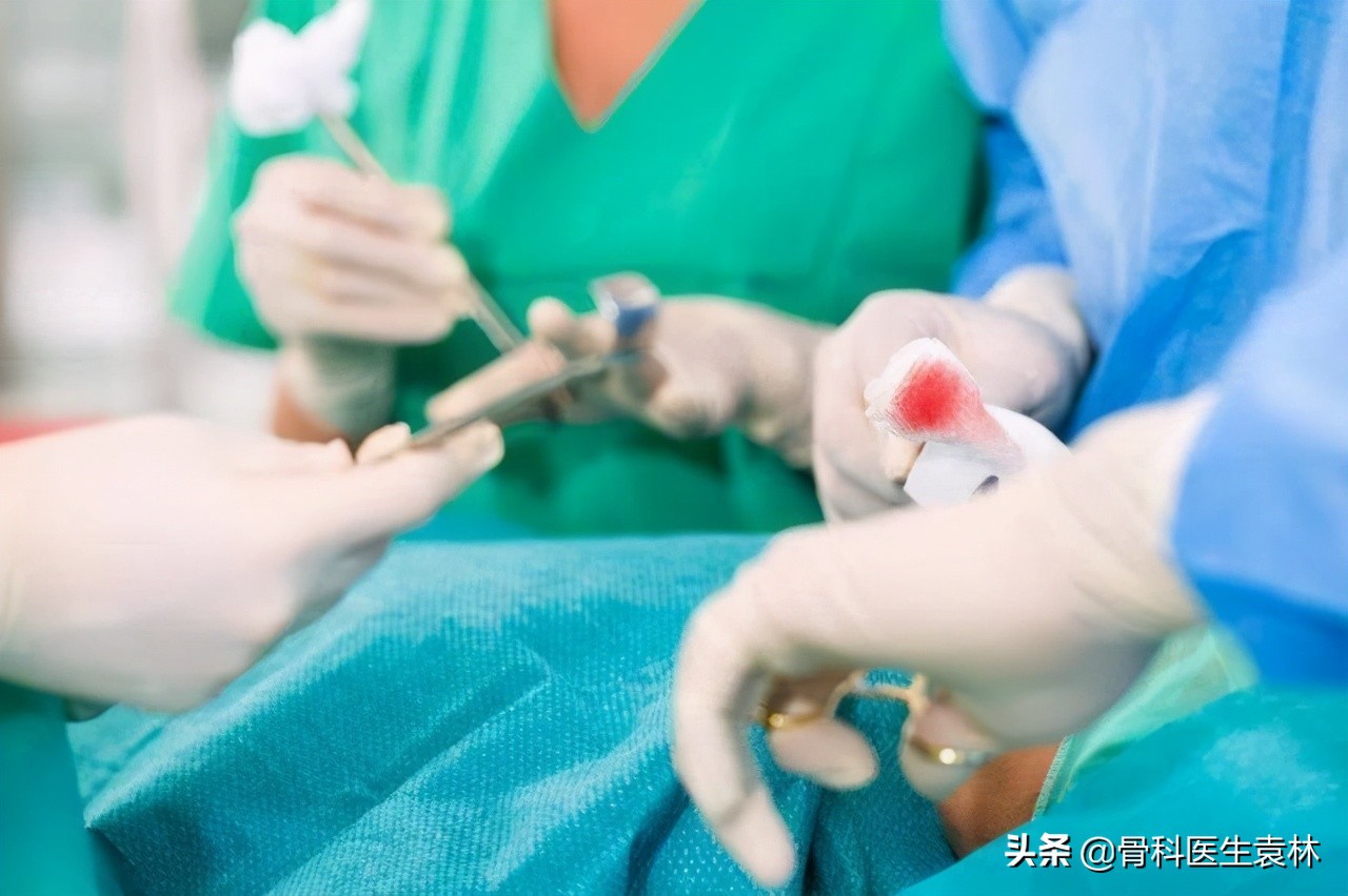 膝关节肿胀疼痛有积液怎么办,膝关节积液伴有疼痛要怎么治疗