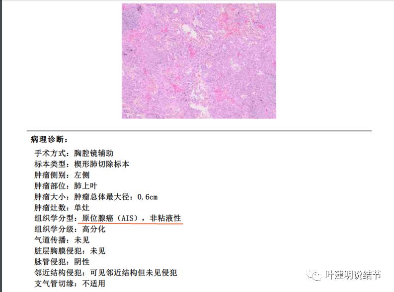 怎样从病理报告看是不是原位癌,原位腺癌切除子宫要开刀吗
