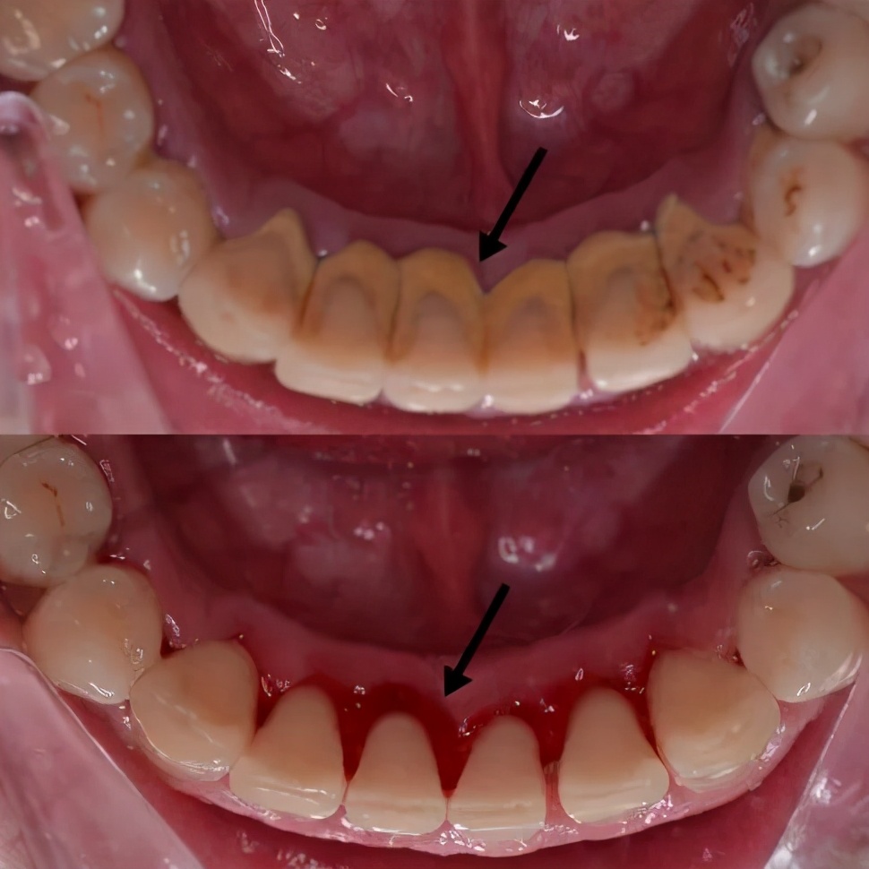 “老掉牙”不是正常现象？30个医生最想告诉你的秘密